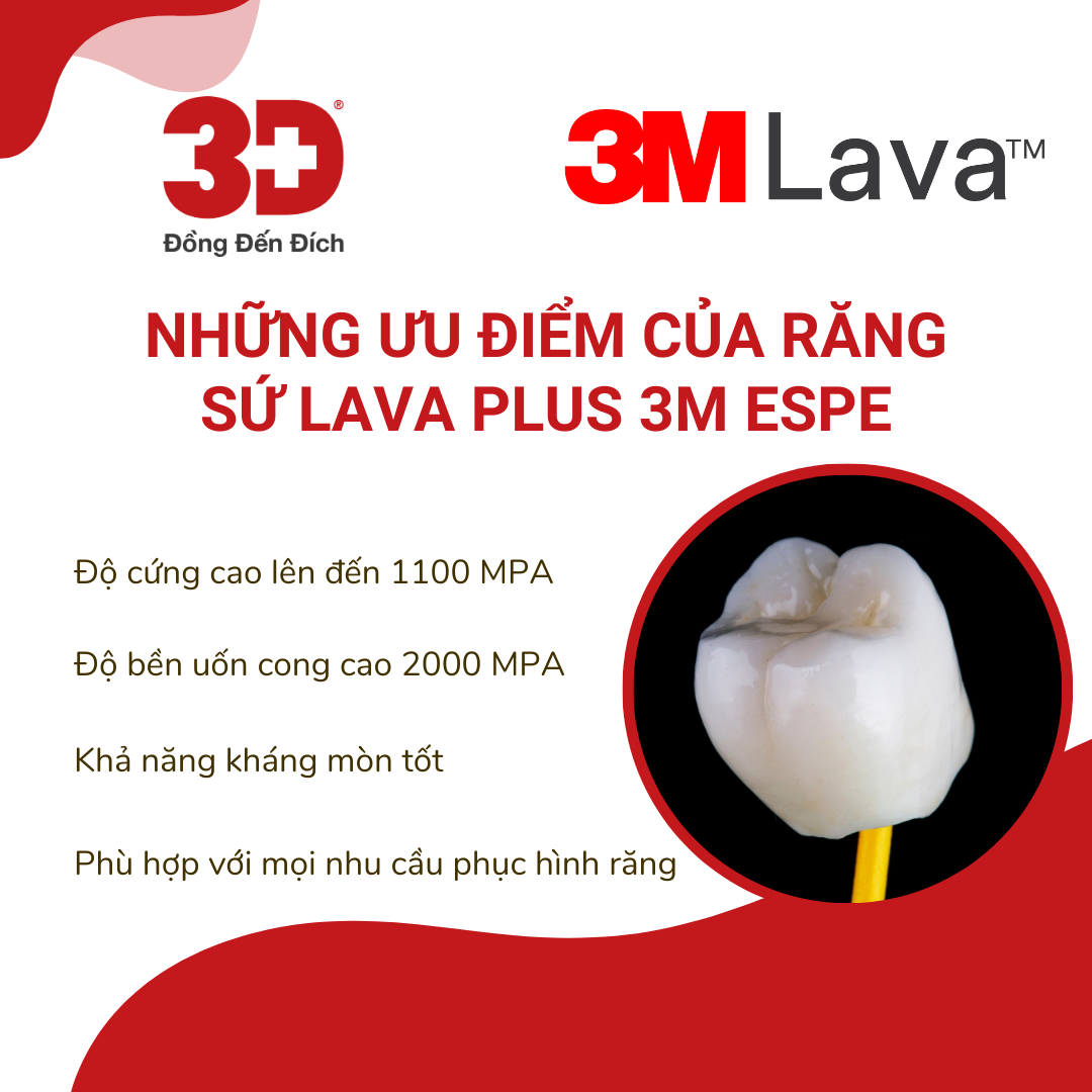 Text: Ưu điểm của răng sứ lava plus 3m espe